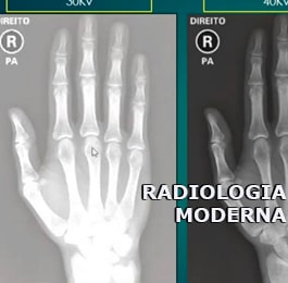 Cursos online de radiologia